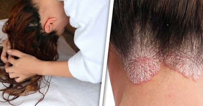 7 Problems Can Be Encountered if You Have Wet Hair When You Go