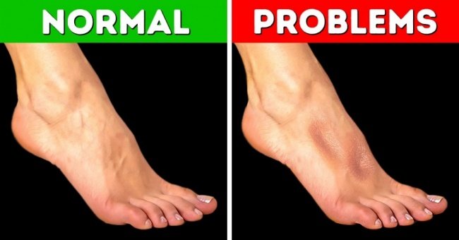 7 Ways to Self-check Out the Very Simple Health Situation at Home