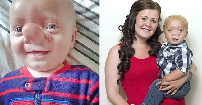 8 Incredible and Incredible Diseases in Real Life Step Out