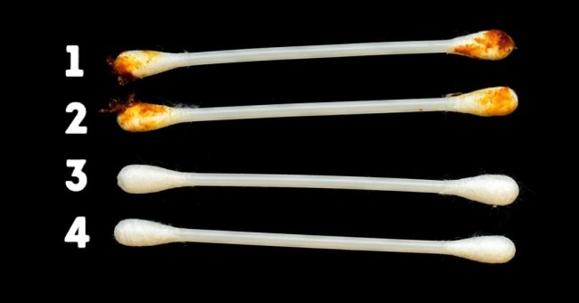 8 Signs from Ear Wax Reveal Your Current Health Condition
