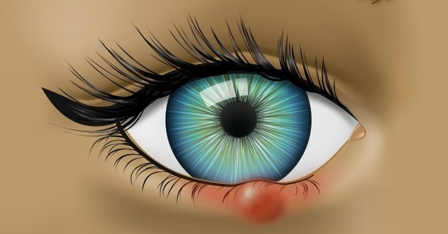 8 Signs of Abnormal Eye Warning About Your Health