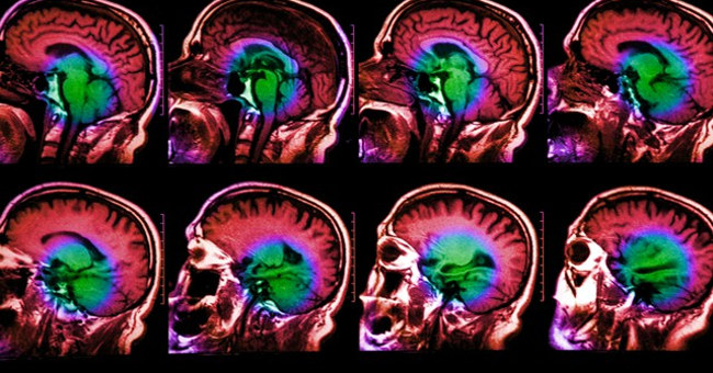 A Total of More Than 100 Human Memory-related Genes Have Been Identified