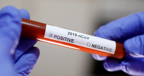Alibaba's AI Identifies Covid-19 Infections with an Accuracy of