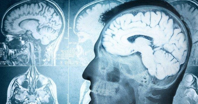 Alzheimer's Can Help Treat Patients with Brain Injury