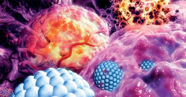 Announcing the Method of 'Hacking' Cancer Metastasis with Nano Particles