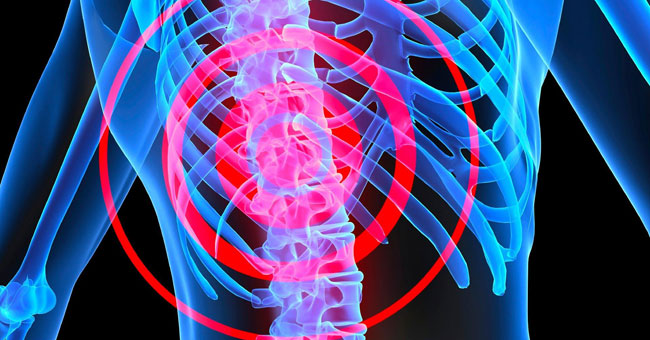 Anti-rejection Drugs Can Reduce Spinal Cord Injuries
