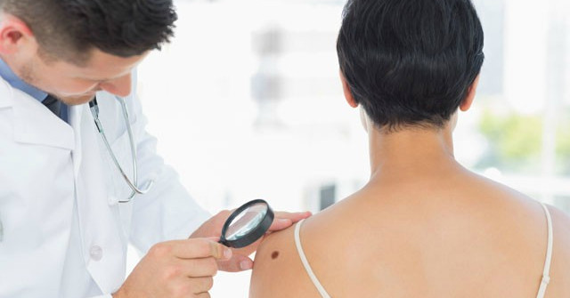 Artificial Intelligence Can Help Detect Melanoma Skin Cancer