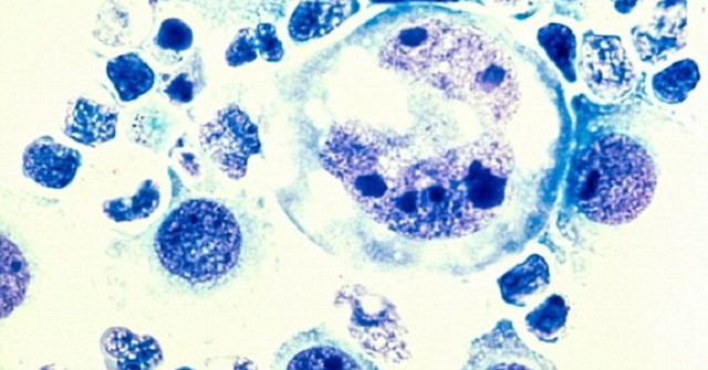 Bowel Bacteria Help Anti-cancer Immunotherapy Work Better
