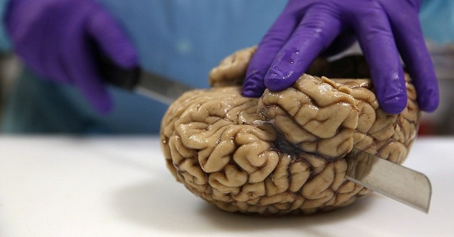 Breaking into the Bank Holds 1,000 Human Brains in the UK