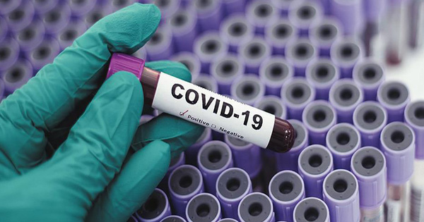 Covid-19 Is Unlike Seasonal Flu, It Is Dozens of Times More