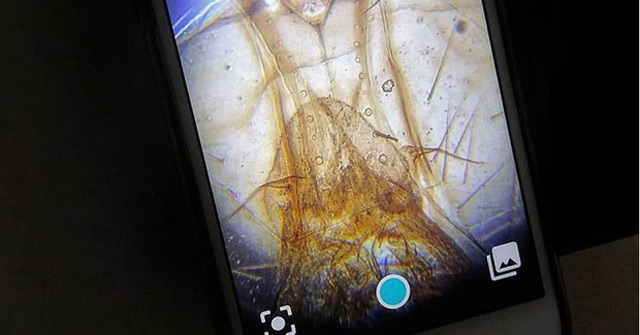 Diple, a Tool That Turns a Smartphone Camera into a Microscope