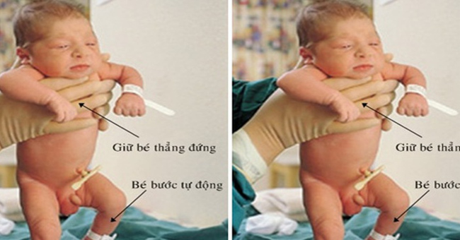 Explaining the Strange Phenomenon the Baby Just Born Has Walked