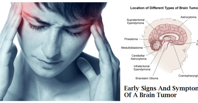 Find Out Many Causes of Mental Disorders in Cancer Patients