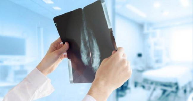 Finding New Drugs That Treat Breast Cancer Is Thought to Be Well Tolerated