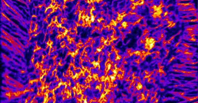Finding New Ways to Study Cholesterol Distribution on Cells