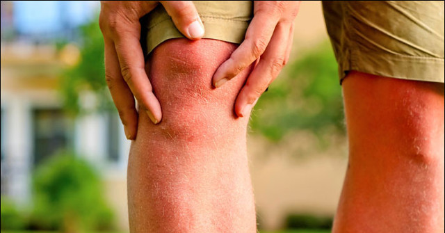 Good News: New Drugs Can Prevent Damage and Bone Loss Caused