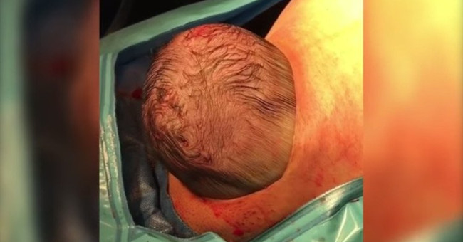 Hold Your Breath to See the Process of Your Baby Coming Out