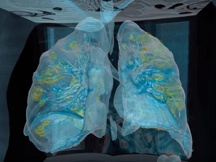 Hospital Uses VR to Show How the Coronavirus Impacts the