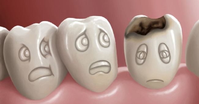 how-does-the-process-of-tooth-decay-take-place