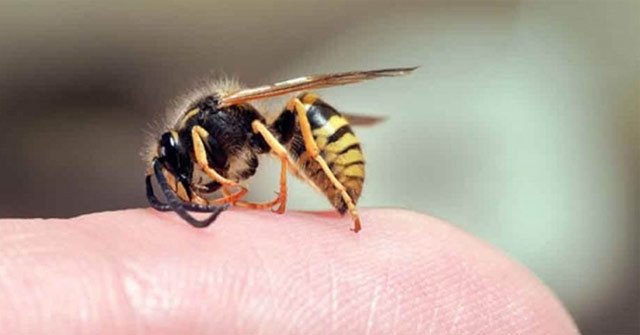How to Handle Bee Stings: Step-by-Step Guide