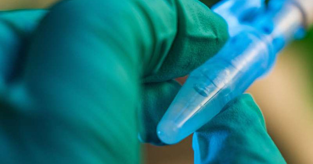 Hydrogel Can Help Heal Diabetes Ulcers