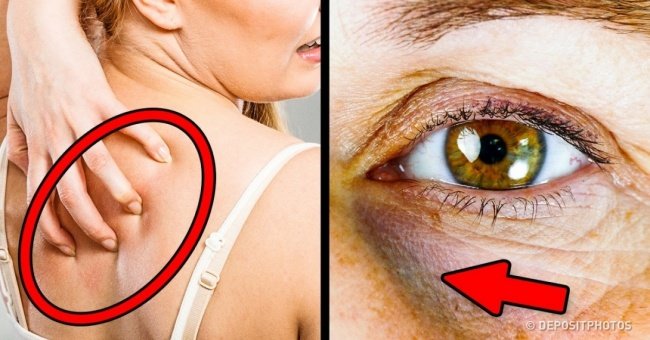 If Your Body Has These 12 Signs, You Are Eating Too Much Sugar