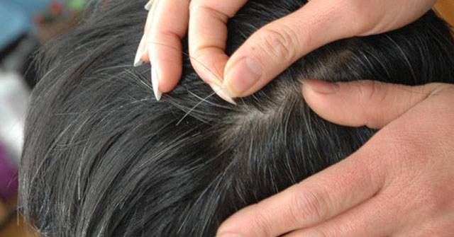 Pluck Gray Hair: Immeasurable Harm from Plucking Silver Hair