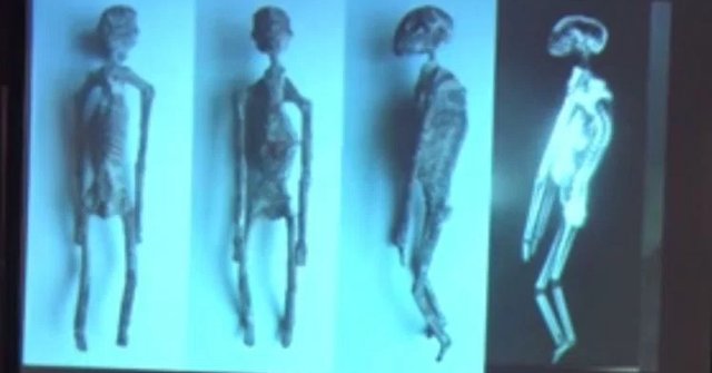 Is the Alien Skeleton Found in Peru True: Alien Mummies