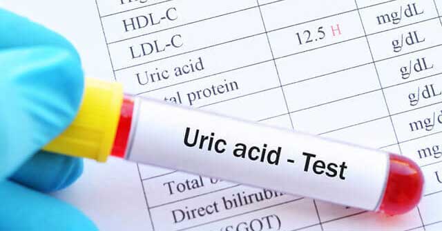Uric Acid Is Low: Is the Blood Uric Acid Index Low?