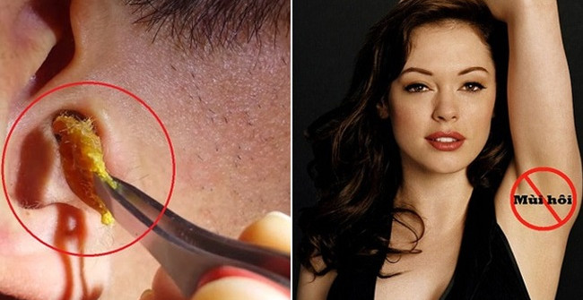 Looking at the Earwax, You Will Know Right Away if You Are