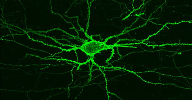 MIT's Imaging Techniques Shed Light on Brain Activity