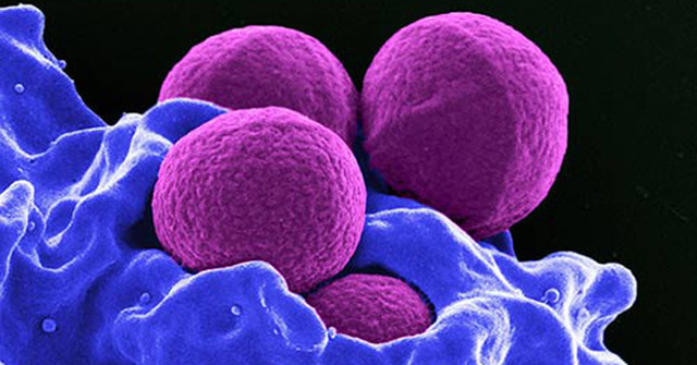 NASA Launched E. Coli into Space to Study Antibiotic Resistance of Bacteria