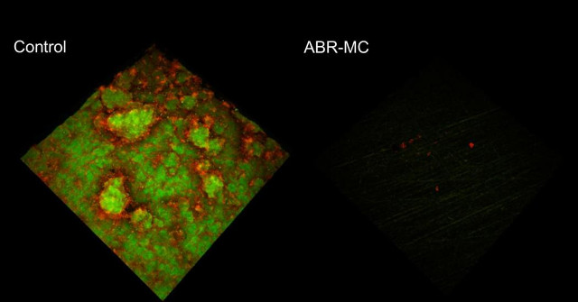 New Dental Materials Help Prevent Plaque, Kill Bacteria