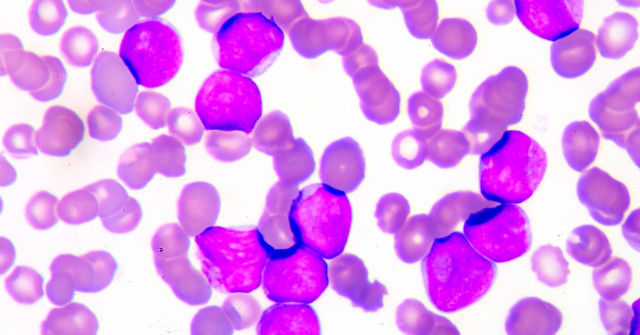 New Treatment for Blood Cancer Has Just Been Recognized
