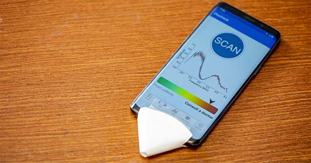 No Need to Go to the Hospital Can Still Diagnose Middle Ear Otitis with a Smartphone Application