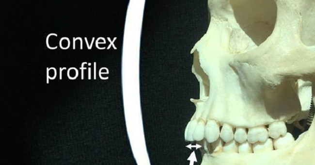 People with Long, Thin Faces Can Be Left-handed