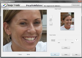 Photoshop - the 'White' Tool for Photos