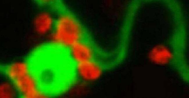 Plants Use Hydrogen Peroxide as Sunscreen