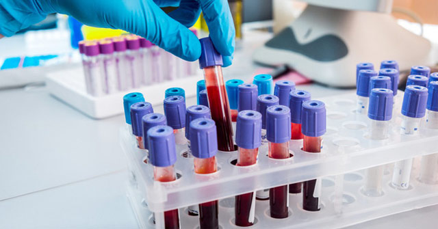 Predictable Death Through Blood Test, Accuracy up to 83%