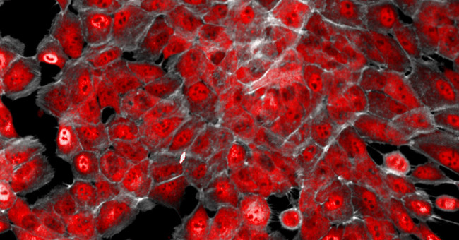 Researchers Found New Antibodies to Kill Cancer Cells