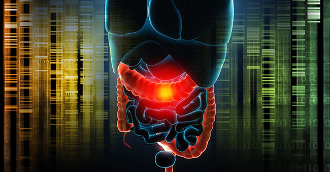 Science Discovered the Role of Foreign Genes in Inflammatory Bowel Disease