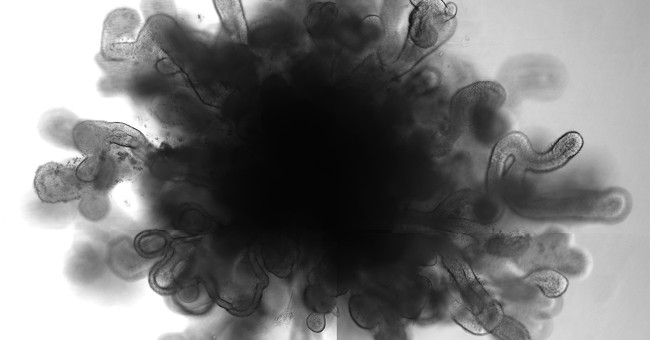 Science Successfully Created 3D Lung Models with the Size and Characteristics of True Lungs