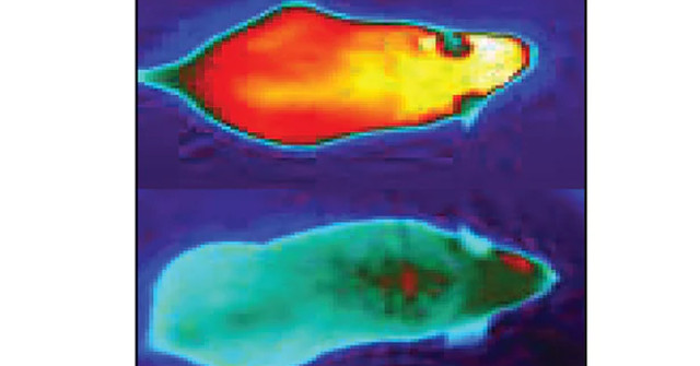 Scientists Identify Genes Capable of Burning Brown Fat