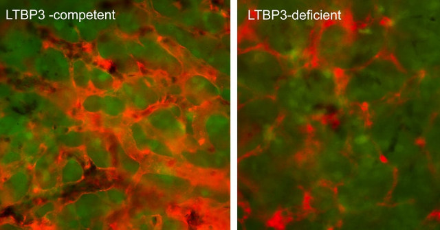 Scientists Who Find Proteins Can Prevent Metastatic Cancer