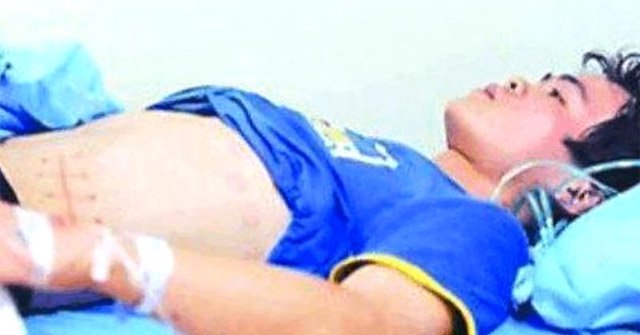 Selling Kidneys to Buy iPhone 4, This Young Man Had to Stay in Hospital for 7 Years