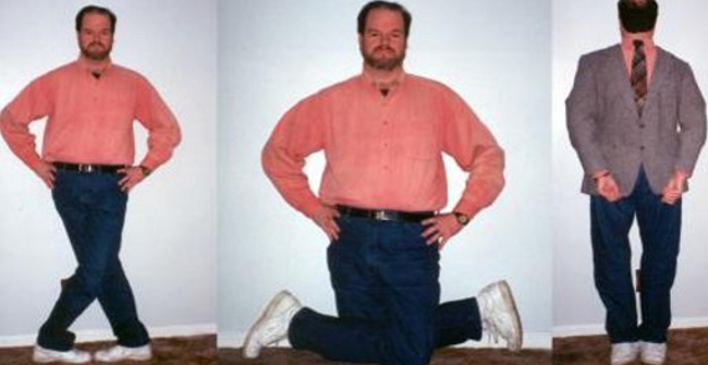 Strange Story: the Man Can Turn 180 Degrees Upside Down
