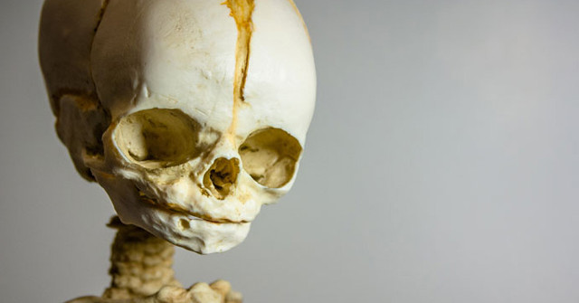 Strange: the Woman 'Gave Birth in the Coffin' After Being Buried