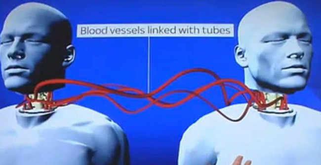 Successful Chinese Professor of Surgical Surgery Implanted