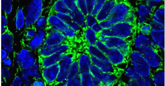 Successfully Created Human Kidney Tissue from Stem Cells