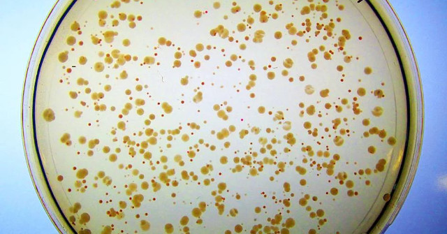 Synthetic Enzymes Can Be Catalysts for Artificial Life